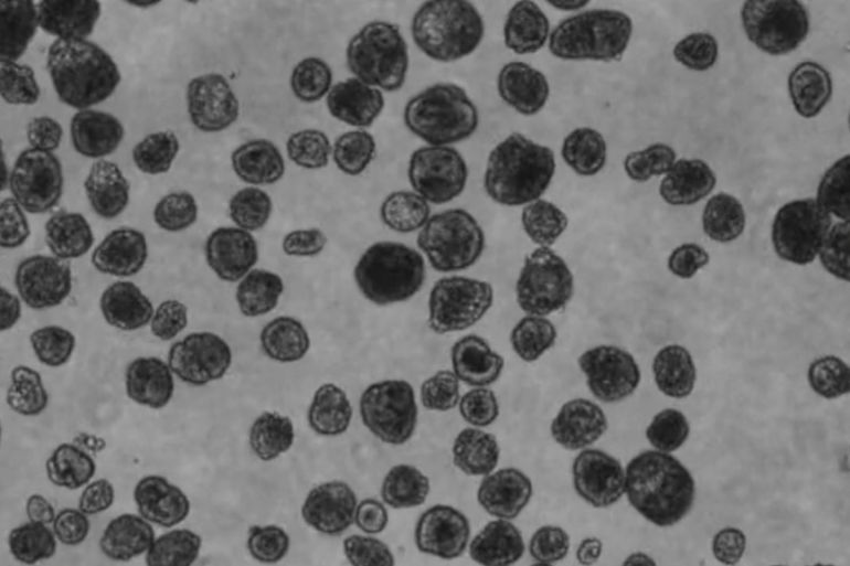 هذه الجزيئات تولد قوى صغيرة تضغط على الغشاء وتشده، فينثني ويتذبذب على مقياس النانو (جيزيم غوموسكايا)