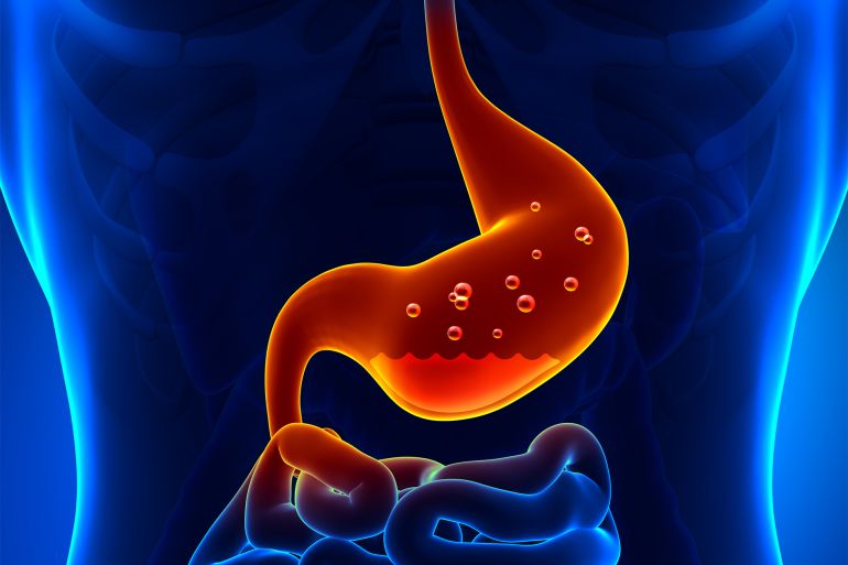 With the Wise One... Tips to Avoid Stomach Acidity and Acid Reflux