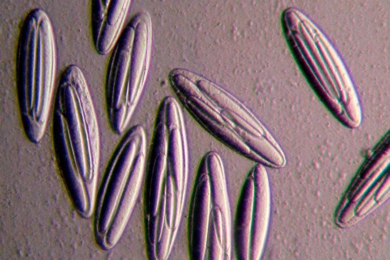 صورة مجهرية لمجموعة من بكتيريا Epulopiscium viviparus.